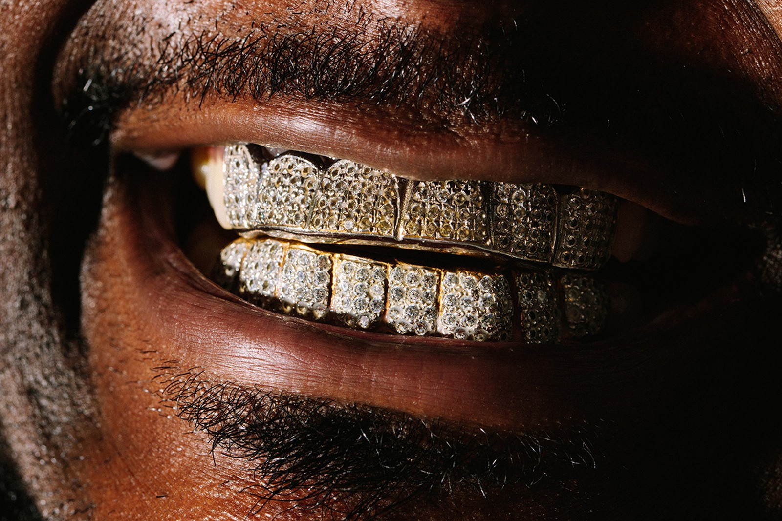 GRILLZ เครื่องประดับฟันสุดจี๊ด ที่สายคนรักฮิปฮอปต้องรู้จัก!